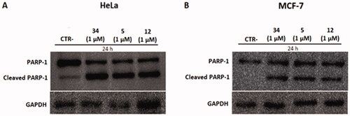 Figure 11. Protein levels of PARP-1 and cleavage of PARP-1 in HeLa and MCF-7 cell lines after treatment with compounds 5 and 12 at 1 µM. Caspase-mediated cleavage of PARP1indicated activation of cell death by apoptosis in both cell lines. DMSO and compound 34 were used as negative and positive controls, respectively. All results were normalised using GAPDH.
