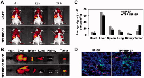 Figure 5. In vivo tumor targeting assay was performed on SCLC-bearing mice models. (A) In vivo imaging of SCLC-bearing mice after respectively injected with DiR-labeled NP-EP and TPP1NP-EP. (B) Ex vivo imaging of dissected organs (heart, liver, spleen, lung, kidney, and tumor) at 24 h post injection of nanocomplexes. (C) Semi-quantitative analysis of bio-distribution of nanocomplexes in SCLC-bearing mice models. (D) Distribution of nanocomplexes in tumor tissues with the red represents vessels stained with CD-31, the blue represents nuclei stained with DAPI, and the green represents nanocomplexes labeled with FITC. The bar represents 200 μm. ***p<.001 indicates the statistical difference versus NP-EP group.
