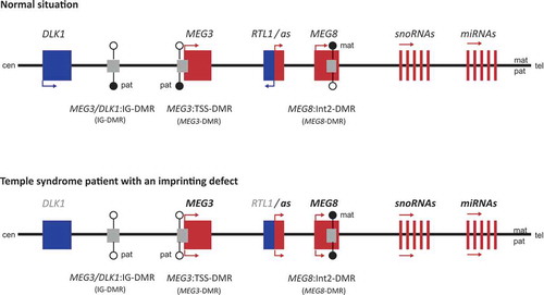 Figure 1. Overview of the chromosomal region 14q32.The figure gives an overview of the imprinted gene cluster on chromosome 14q32. Maternally expressed genes are indicated in red, paternally expressed genes in blue. The region harbors three differentially methylated regions (DMRs): the MEG3/DLK1:IG-DMR and the MEG3:TSS-DMR that are methylated on the paternal allele (pat) and the MEG8:Int2-DMR which is methylated on the maternal allele (mat). The methylation status is indicated by filled (methylated) and empty (unmethylated) lollipops. Expression of the genes is indicated by arrows.The situation in TS14 patients is given below. The MEG3/DLK1:IG-DMR and the MEG3:TSS-DMR are unmethylated on both alleles while the MEG8:Int2-DMR is methylated on both alleles. This leads to an increased expression of the maternally expressed genes (indicated by bold gene names) while the paternally expressed genes are silenced (indicated by grey gene names).Modified from Beygo et al. 2017 [Citation8].