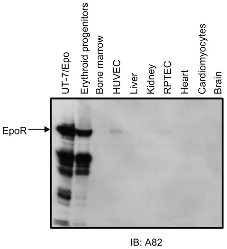 Figure 4 High-level erythropoietin receptor (EpoR) protein expression is found in erythroid cells but not in other tissues. EpoR expression was analyzed by Western immunoblot analysis with anti-EpoR antibody A82 that was shown to specifically detect human EpoR in erythroid cells.Citation78 The arrow shows the location of full-length EpoR. Smaller proteins have been shown elsewhere to be EpoR fragments.Citation78 UT-7/ Epo cells (EpoR positive control) are derived from a megakaryoblastic leukemia and are Epo-dependent.Citation462