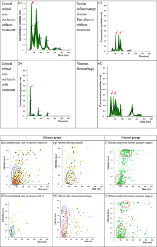 Figure 2. The distribution of particle size in aqueous fluid of patients with central retinal vein occlusion, ocular inflammatory and vitreous hemorrhage. The Y-axis represents exosome concentration (particles/ml) and the X-axis represents the size of each exosome (in nanometers). (a) Patient with central retinal vein occlusion without treatment. The major peak was at 68 nm width (red arrow). The total concentration was 2.62 × 109 ± 9.97×108 particles/ml. (b) One month after the patient with central retinal vein occlusion received an anti-vascular endothelial growth factor injection. After treatment, the total concentration decreased to 2.90 × 108 ± 2.02×108 particles/ml, and the major peak was at 48 nm width (red arrow). (c) Patient with ocular inflammatory disease(pars planitis) without treatment. The total concentration was 4.47 × 109 ± 9.22×108 particles/ml. The peak concentrations of nanoparticles were at 113 and 159 nm (red arrow). (d) Patient with vitreous hemorrhage. The total concentration was 1.18 × 109 ± 5.02×108 particles/ml. The peak concentrations of nanoparticles were at 50 and 88 nm (red arrow). Nanoparticle tracking analysis showing exosome size (X axis) and signal intensity (Y axis) in the aqueous humor from patients with different ocular conditions. Each sample was tested three times. The patient with central retinal vein occlusion (e,g) had a large number of exomeres, however the number obviously decreased after treatment. (g) The patient with ocular inflammation (pars planitis) had mainly large exosomes. (h) The exosomes in the patient with vitreous hemorrhage were mostly exomeres. The control group had two clusters of exosomes that were different compared with the disease group. In the control group, there were two major clusters with the same distribution pattern, which one cluster at 100 nm and the other at approximately 200 nm. Compared with the control group, the disease groups had a clearly different pattern.