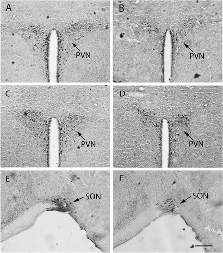 Figure 4. Oxytocin immunopositive staining in female mandarin voles. Sham-S and Sham-C (A and B); OVX-S and OVX-C (C and D); OVX-S and OVX-C (E and F). PVN, paraventricular nucleus; SON, supraoptic nucleus. Sham-S and Sham-C: sham-ovariectomized females injected with saline and cocaine, respectively; OVX-S and OVX-C: ovariectomized females injected with saline and cocaine, respectively. Scale bar: 200 µm.