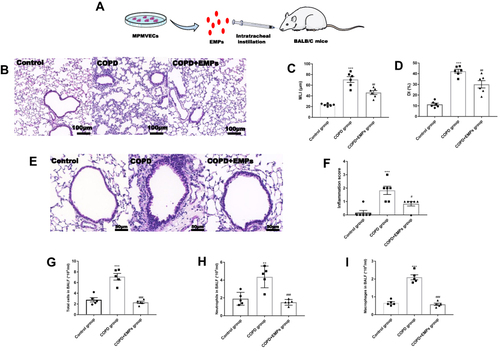 Figure 3 Effect of endothelial microparticles (EMPs) on pathological changes in COPD mice. (A) Treating diagram of EMPs from mouse pulmonary microvascular endothelial cells (MPMVECs) on COPD mice; (B) Pathological changes in mouse lung sections with hematoxylin and eosin (HE) staining; (C) Morphometric measurements of MLI (μm); (D) Morphometric measurements of DI (%); (E) Pathological changes in mouse airway with HE staining; (F) Lung inflammation scores in mice; (G) The number of total cells in mouse bronchoalveolar lavage fluid (BALF); (H) The number of neutrophils in mouse BALF; (I) The number of macrophages in mouse BALF. Data are presented as the mean ± SEM. **p<0.01 in comparison with control group, ***p<0.001 in comparison with control group, #p<0.05 in comparison with COPD group, ##p<0.01 in comparison with COPD group, ###p<0.001 in comparison with COPD group.