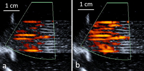 Figure 5. Laminar flow of the in vitro model of perfused tissue observed by pulsed color Doppler ultrasonography during a phase of ‘diastole’ (a) and ‘systole’ (b). Carrier frequency 5 MHz, pulse repetition frequency 100 Hz.