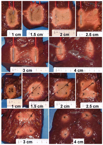 Figure 5. Influence of the inter-electrode distance on the coagulation zone in the axial and transverse planes.