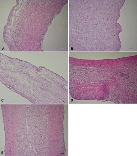 Figure 1. HE stained (A) trypsin, (B) osmotic, (C) trypsin-osmotic, (D) detergent-osmotic decellularized, and (E) control leaflets. Cells were mostly detectable in the fibrosa and ventricularis of trypsin treated valves (A). Osmotic (B) and detergent-osmotic (D) treatment did not remove any cells from the valves when compared to controls. Trypsin-osmotic decellularization (C) resulted in an almost completely acellular matrix. Only a few interstitial cells are present. Scale bar 50μm.