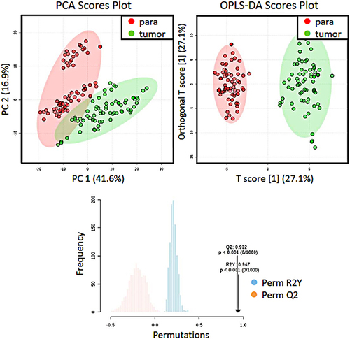 Figure 1 PCA, OPLS-DA models and permutation test. PCA and OPLS-DA score plots of metabolites from the tumor area (green dots) and the adjacent area (red dots) were shown in above and permutation test for OPLS-DA was shown in bottom.
