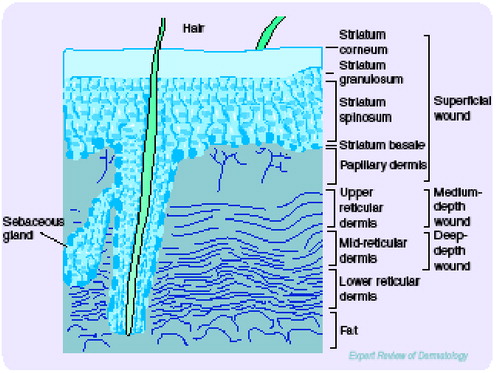 Figure 1. Depth of chemical peel.A light peel (superficial) stimulates epidermal growth.A medium peel causes epidermal regeneration and upper dermal renewal. A deep peel results in epidermal and dermal regeneration.