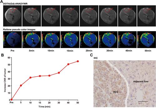 Figure 4 MR imaging with DOTA(Gd)-ANADYWR in a c-Myc transgenic mouse. (A) Representative T1-weighted MR images and corresponding rainbow pseudo color images for a c-Myc transgenic mouse bearing an HCC lesion (The red arrowheads indicated the HCC. The red dotted circles delineated the area of interest that used for CNR analysis). (B) The increase CNR values of tumor before and at different time points after injection of DOTA(Gd)-ANADYWR. (C) Integrin α6 expression was analyzed using immunohistochemistry IHC in tumor tissue (Scale bar, 50μm).