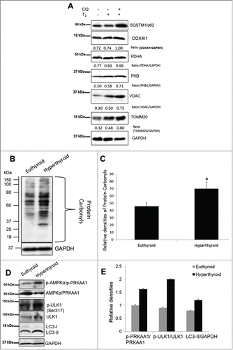 Figure 12. T3 increases oxidative stress and mitophagy in vivo. (A) A representative immunoblot using whole cell lysates showing hepatic levels of mitochondrial proteins in vehicle (PBS), T3 (10 µg/100 g B.W. for 3 d) - and T3+CQ (i.p. administration CQ at 60 mg/kg B.W. for 3 d) - treated mice. (B) Protein oxidation analysis using the Oxyblot method on liver tissues from euthyroid and hyperthyroid (injected with 10 µg T3/100 g B.W. for 3 d) mice. (C) Quantification of Oxyblot assays (n = 5). (D and E) Representative blots and densitometric analysis showing total and phosphorylated PRKAA1/AMPK, ULK1, and LC3-II in whole cell lysates after T3 treatment (10 µg T3/100 g B.W. for 3 days) in vivo. Bars represent the mean of the respective individual ratios ±SD (n = 5). Asterisk indicates P < 0.05.