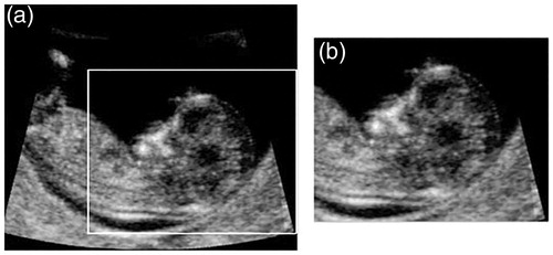 Figure 1. An example of the data reduced according to the size and position of the fetal head. (a) The xy-plane of the original 3D data. (b) The xy-plane of the reduced 3D data.