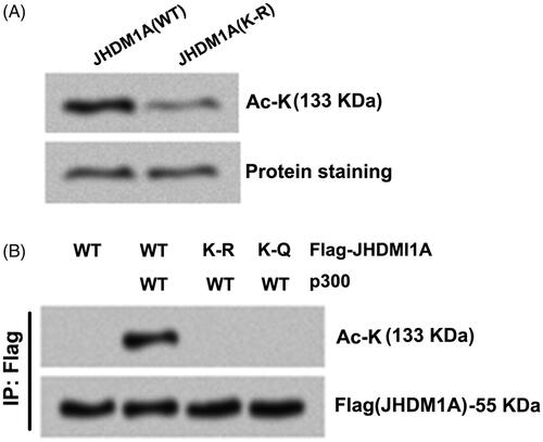 Figure 2. p300 directly acetylated JHDM1A at lysine residues 409 (K409). (A) K409 site of JHDM1A was replaced using arginine (R) to form acetylation-resistant (K-R mutated) JHDM1A. p300 immuno-precipitates (from Flag-p300 expressed in HEK293 cells) and recombinant full-length wild-type (WT) JHDM1A protein or K-R mutated JHDM1A protein (from bacteria) were co-incubated. Immunoblotting assay with pan-acetyl-lysine (Ac-K) antibody showed that the K-R mutated JHDM1A was resistant to p300-mediated acetylation. (B) K409 site of JHDM1A was replaced using glutamine (Q) to form acetylation-mimicking (K-Q mutated) JHDM1A. p300 and Flag-tagged WT (or K-R, K-Q mutated) JHDM1A were co-transfected into HEK293 cells. Immunoprecipitation (IP) assay with anti-Flag antibody and immunoblotting assay with Ac-K antibody showed that both K-R JHDM1A and K-Q JHDM1A were resistant to p300-mediated acetylation.