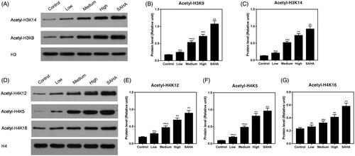 Figure 6. Effects of resveratrol on ACHN cells may be involved in histone acetylation. (A–C) Expression of acH3K9 and acH3K14 was assessed at the protein level by Western blot. (D–G) Expression of acH4K12, acH4K5 and acH4K16 was increased by resveratrol at the protein level using Western blot. All data were expressed by means ± SEM. ∧p < 0.05, ∧∧p < 0.01 vs. SAHA, *p < 0.05, **p < 0.01 vs. Control.