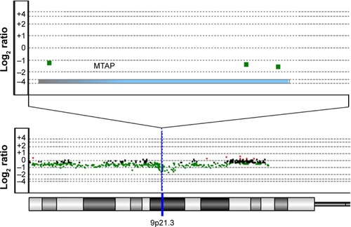 Figure 1 MTAP deletion in ESCC analyzed by array-based comparative genomic hybridization.