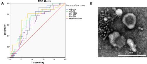 Figure 4 (A) The receiver operating characteristic (ROC) curve of five miRNAs. (B) Electron-microscope scanning of isolated exosomes from the serum of BTCs patients.