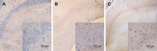 Figure 2 Expression of BDNF-positive cells in the hippocampal CA3 region in the three groups (IHC staining, 400×): (A) control group; (B) 5-Hz EA group; (C) 50-Hz EA group.