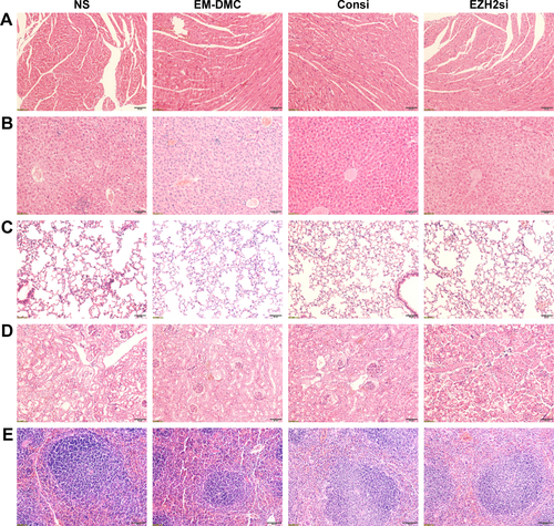 Figure S2 Toxicity assessment in vivo with pathological section.Notes: Histological examinations of HE-stained (A) heart, (B) liver, (C) lung, (D) kidney, and (E) spleen. No significant pathological changes were detected. Scale bar is 50 µm.