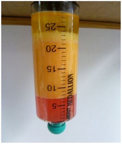 Figure 14 Close-up of a disposable processing syringe containing extracted tissue that has separated.