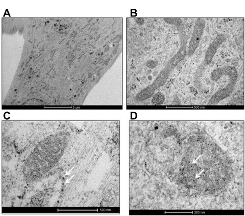 Figure 1 Uptake of AgNPs by CRL-2014 cells. (A) Low- and (B) high-power TEM images of untreated cells (controls); (C) low- and (D) high-power TEM images of treated cells. As shown by TEM, after exposure of cells to AgNPs, NPs were internalized and distributed within the cell (white arrows) (C). AgNPs were mainly found in the mitochondria (white arrows) (D). Some NPs agglomerates are found (C and D).Notes: Original magnification in (A) is 4,200×, whereas original magnification in (B) is 43,000×; original magnification in (C) is 43,000×, whereas original magnification in (D) is 87,000×.Abbreviations: AgNPs, silver nanoparticles; NPs, nanoparticles; TEM, transmission electron microscopy.