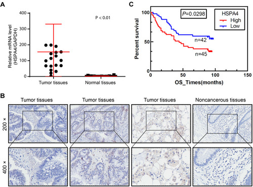 Figure 1 HSPA4 is highly expressed in CRC. (A and B) Expression levels of HSPA4 in CRC tumor tissues and adjacent normal tissues were detected by qRT-PCR (A) and IHC staining (B). (C) Kaplan-Meier survival analysis of HSPA4 expression and overall survival in CRC patients. Data are presented as mean ± SD (n = 3) of three triplicates or independent experiments.