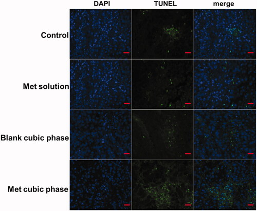 Figure 5. Representative micrographs of tumor tissue stained by TUNEL on day 12 post-administration. Scale bar, 100 μm.