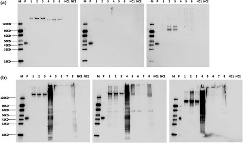 Figure 3. A Western blot analysis of cell culture supernatant from 293-6E cells respectively transducted with wide type, p.Y177C, p.W884X mutation plasmid. Lane M: Protein Marker, Lane P: Multiple-tag (GenScript, Cat.No.M0101) as positive control, Lane 1∼3: Cell culture supernatant from day 2, day 4 and day 5 under a reducing condition, Lane 4∼6: Cell culture supernatant from day 2, day 4 and day 5 under a non-reducing condition, Lane NC1: Negative control under a reducing condition, Lane NC2: Negative control under a non-reducing condition. B Western blot analysis of cell lysate from 293-6E cells respectively transducted with wide type, p.Y177C, p.W884X mutation plasmid. Lane M: Marker, Lane P: Multiple-tag (GenScript, Cat.No.M0101) as positive control, Lane 1∼3: Cell lysate supernatants from day 2, day 4 and day 5 post-transfection under a reducing condition, Lane 4: Cell debris from day 4 post-transfection under a reducing condition, Lane 5∼7: Cell lysate supernatants from day 2, day 4 and day 5 post-transfection under a non-reducing condition, Lane 8: Cell debris from day 4 post-transfection under a non-reducing condition, Lane NC1: Negative control under a reducing condition, Lane NC2: Negative control under a non-reducing condition.