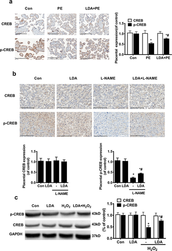 Figure 4. LDA increases the CREB phosphorylation level which is reduced in PE placental trophoblasts and H2O2-induced HTR8/SVneo trophoblast cells. The expression of CREB and the phosphorylated CREB in human placental tissues was detected by immunohistochemistry (a) (n = 14-16, *P < 0.05, vs. con, #P < 0.05 vs. PE) and in PE model rat placenta tissues (b) (n = 5, *P < 0.05 vs. con, #P < 0.05 vs. L-NAME); c. HTR8/SVneo trophoblast cells were treated with 200 µmol/L H2O2 for 24 h and pretreated with LDA for 30 min; the effects of LDA on CREB activation were evaluated by detecting the expression and activation of CREB and p-CREB using western blotting. Densitometric analysis of the expression of CREB and p-CREB is shown in the bar graphs (n = 5, *P < 0.05, vs. con, #P < 0.05 vs. H2O2).