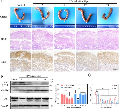 Figure 5. Autophagy inhibition in the placenta of pregnant ICR mice with HEV genotype 3 infection. (a) Images of uterus, H&E staining, LC3 immunohistochemical staining. (b) Western blot and (c) qRT-PCR of LC3 and p62 in the placenta with different time HEV infection. Bars indicate mean ± SEM, n = 3. **P < .01.