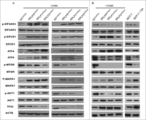 Figure 6. Upregulation of proteins related to the UPR and autophagy. MCF-7 cells expressing RPLP0 shRNA, RPLP1 shRNA, RPLP2 shRNA, or NT shRNA vectors, untreated (DMSO) (A) or treated (B) with the autophagy inhibitor 3-MA (10 mM), were immunoblotted for the indicated proteins (phospho- or total). Expressions of p-EIF2AK3, p-EIF2S1, p-MTOR, p-AKT1, and p-MAPK1 were compared with those of total proteins (EIF2AK3, EIF2S1, MTOR, AKT1, and MAPK1, respectively). Expressions of ATF4, ATF6, and TP53 were compared with those of ACTB (used as a loading control). Parental MCF-7 cells treated with Sts (2 µM) were used as a control for apoptosis.
