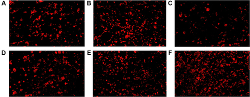 Figure 4 CD4+ TILs in tumor microenvironment of mice inoculated with breast cancer cells. (A) Inoculation of 4T1 cells. (B) Inoculation of 4T1 cells and metformin administration. (C) Inoculation of 4T1 cells with JNK knock-down. (D) Inoculation of 4T1 cells with JNK overexpression. (E) Inoculation of 4T1 cells with JNK knock-down and metformin administration. (F) Inoculation of 4T1 cells with JNK overexpression and metformin administration.