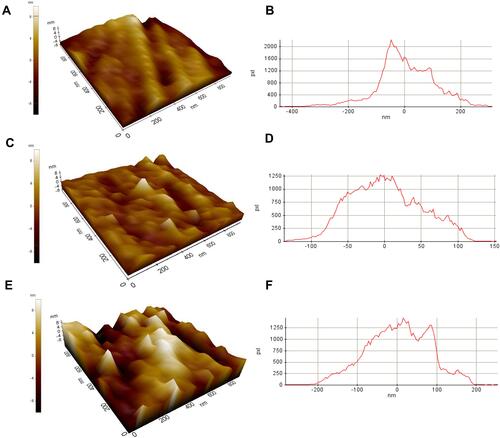 Figure 4 AFM surface images (10 × 10 ㎛2) in (A) control group, (C) Z group, (E) ZH group, AFM profile (10 × 10 µm2) of (B) control group,(D) Z group, (F) ZH group.