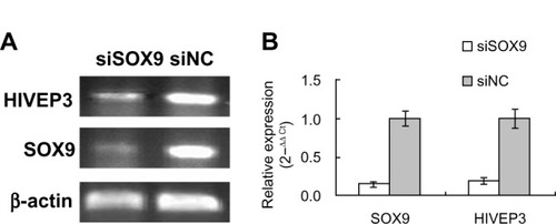 Figure 1 Downregulation of SOX9 expression by siRNA interference inhibits HIVEP3 expression in PCa cells.