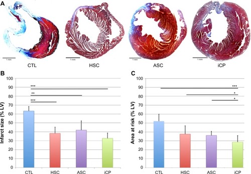 Figure 8 Analysis of the effect of iCP transplantation on remodeling of the left ventricle.