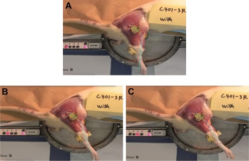 Figure 1 Pictures of the automatic arthrometer developed by The Bone and Joint Laboratory and used to measure the knee ROM in extension.