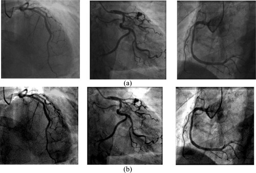 Figure 3. (a) Original image (b) Pre-processed images.