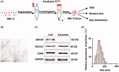 Figure 1. Isolation and identification of AML12 cell-derived exosomes. (A) Schematic representation of the exosomes isolation procedure; (B) representative TEM (transmission electron microscope) image of the isolated exosomes (scale bar = 100 nm); (C) western blot analysis of the expression of exosomal markers GM130, TSG101 and CD63 in the isolated exosomes and the parental cells. GAPDH served as the loading control; (D) size distribution of the isolated exosomes.