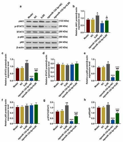 Figure 5. (a-h) Western blot was used to detect the expressions of JAK1, p-STAT3, STAT3, p-p65 and p65 in the Model, NC, IL-6 R, agomiR-125-5p + NC, agomiR-125-5p + IL-6 R group. All the experiments have been performed in triplicate. β-actin was used as a control. * P < 0.05, ** P < 0.01, *** P < 0.001 vs. NC; ## P < 0.01, ### P < 0.001 vs. IL-6 R; ^ P < 0.05, ^^^ P < 0.001 vs. agomiR-125-5p + NC