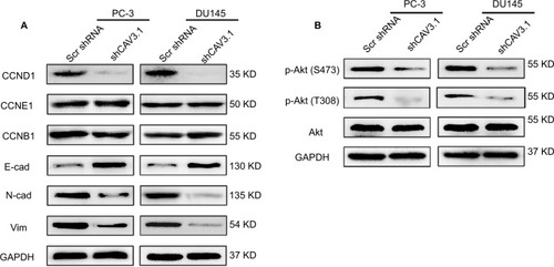 Figure 4 The influences of CAV3.1 knockdown on expressions of proteins involving cell cycle, EMT, and Akt activity in PCa cells.Notes: (A) CAV3.1 knockdown led to decreased CCND1, but not for CCNE1 and CCNB1 in PC-3 and DU145 cells. Moreover, CAV3.1 knockdown led to decreased N-cad and Vim, 2 mesenchymal markers, and increased E-cad, an epithelial marker. (B) CAV3.1 knockdown led to decreased p-Akt (S473) and p-Akt (T308) in PC-3 and DU145 cells.Abbreviations: E-cad, E-cadherin; EMT, epithelial–mesenchymal transition; GAPDH, glyceraldehyde-3-phosphate dehydrogenase; N-cad, N-cadherin; PCa, prostate cancer.