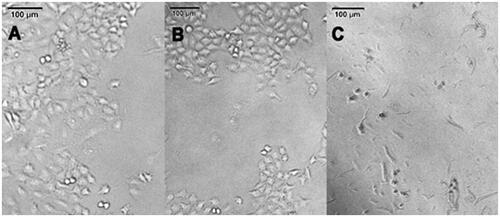 Figure 8. Microscopic images (magnification 100X) of A549 tumor cells after incubation with dopamine of different concentrations. A: Control (RPMI); B: dopamine 0.05 mg/mL; C: dopamine 0.20 mg/mL. The cells at high dopamine concentrations are dead after 24 h incubation.
