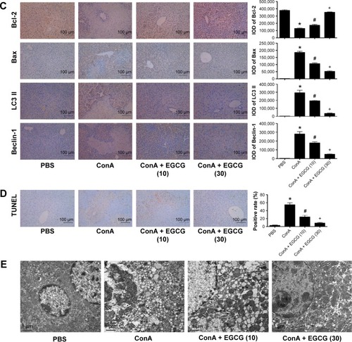 Figure 5 Effects of EGCG on apoptosis and autophagy in mice with ConA-induced acute hepatitis.