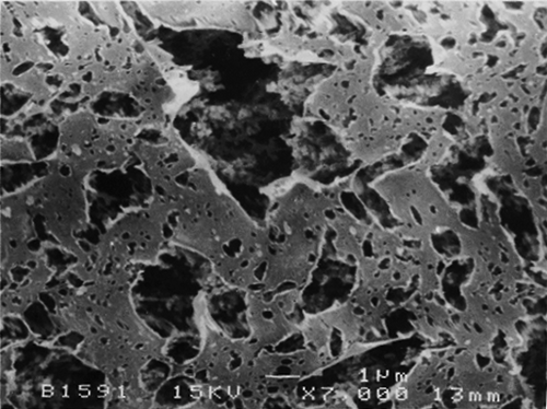 Figure 2 SEM micrograph of calf rennet milk coagulum (7000×).