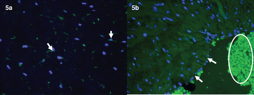 Figure 5.  Immunofluorescence images of HMGB1 immunoreactivity in the umbilical cord Wharton’s jelly and umbilical vein. (a) Umbilical cord Wharton’s jelly obtained from a patient who delivered preterm with acute chorioamnionitis and funisitis. Distinct immunoreactivity of HMGB1 (green) is detected in the stromal cells of the Wharton’s jelly. ×400. (b) Umbilical vein obtained from an uncomplicated pregnant woman who delivered at term. HMGB immunoreactivity (green) is absent in umbilical vein endothelial cells (arrows). Autofluorescence from RBCs are prominent (circle). ×400. DAPI (blue) was used to stain nuclei.