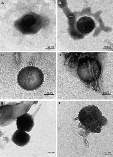 Figure 3 TEM images of pure insulin and insulin-conjugated SWCNTs.Notes: (A) and (B) TEM images of insulin stained with 3% phosphotungstic acid at different magnifications. (C–F) TEM images of insulin-conjugated SWCNTs stained with phosphotungstic acid at various magnifications.Abbreviations: TEM, transmission electron microscopy; SWCNTs, single-walled carbon nanotubes.