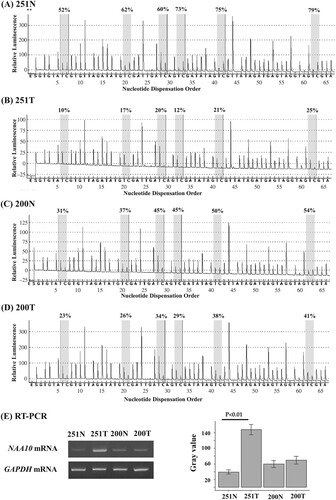 Figure 3. Representative result of pyrosequencing and RT-PCR for the NAA10 gene in NSCLC patients. (A–D) The methylation status of the NAA10 promoter in tumors and normal tissues of NSCLC patients was analyzed by pyrosequencing. The letters on the X-axis represent the dispensation order: E, enzyme; S, substrate; A, G, C, and T, nucleotides. Shaded boxes encompassing T/C pairs indicate six interrogated CpG sites. The methylation level of each site was calculated as the percentage of C incorporation. (E) NAA10 mRNAs expression in primary tissues of NSCLC patients was assessed using semi-quantitative RT-PCR. Band intensities were quantified with ImageJ 1.53t program and the relative amount of NAA10 mRNAs, normalized to GAPDH levels, were expressed as gray values. N, normal tissue; T, tumor tissue.