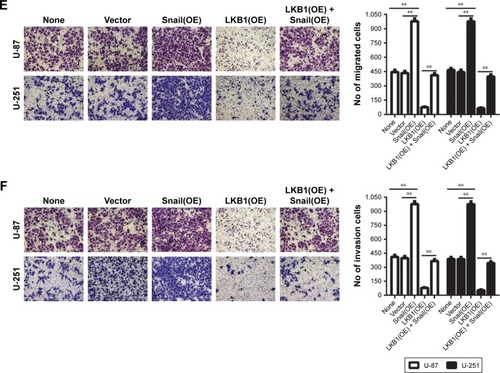 Figure 4 Snail is involved in LKB1-regulated glioma cell proliferation, migration, and invasion.Notes: (A) LKB1 knockdown decreased the protein level of Snail. Other proteins remain unchanged. (B) The overexpression efficiency against Snail was verified by Western blot in U-87 and U-251 cells. (C) Growth curves between none, vector, Snail(OE), LKB1(OE), and Snail(OE) + LKB1(OE) by CCK-8 assay. The results are shown as the mean ± SD of at least three independent experiments. (D–F) Representative images (left panels) and histogram quantification (right panels) of the (D) colony formation assay, (E) Transwell migration, and (F) invasion assays with U-87 and U-251 cells. Statistical significance was assessed using one-way ANOVA followed by Dunnett’s tests for multiple comparisons. Scale bars: 50 µm. **P<0.01 and ***P<0.001.Abbreviations: CCK-8, Cell Counting Kit-8; LKB1, liver kinase B1; OE, overexpression.