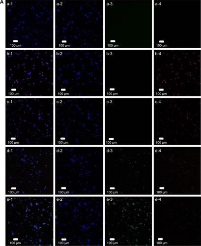 Figure 3 Fluorescent images of staining against p-p38 (A), p-JNK (B), and p-ERK5 (C) in SK-N-MC cells after induction with 10 µM of fibrillar Aβ for 24 h.Notes: (A) (a) Control, (b) Aβ, (c) Aβ + CRM, (d) Aβ + CRM-LIP, and (e) Aβ + CRM-CL/LIP; (B) (a) control, (b) Aβ, (c) Aβ + CRM, (d) Aβ + CRM-LIP, and (e) Aβ + CRM-CL/LIP; and (C) (a) control, (b) Aβ, (c) Aβ + NGF, (d) Aβ + NGF-LIP, and (e) Aβ + NGF-CL/LIP; (1) merged image, (2) blue channel for nuclei, (3) green channel for LIP carriers, and (4) red channel for p-JNK, p-p38, or p-ERK5.Abbreviations: p-p38, phosphorylated p38; JNK, c-Jun N-terminal kinase; p-ERK5, phosphorylated extracellular signal-regulated kinase 5; Aβ, β-amyloid peptide; CRM, curcumin; CRM-LIP, liposomes loaded with CRM; CRM-CL/LIP, cardiolipin-conjugated liposomes loaded with CRM; NGF, nerve growth factor; NGF-LIP, liposomes loaded with NGF; NGF-CL/LIP, cardiolipin-conjugated liposomes loaded with NGF; p-JNK, phosphorylated JNK.