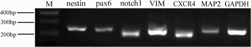 Figure 3. RT-PCR detection of partial NSCs and NSCs progeny markers. Lanes 1–7 show NCSCs expressing markers (Nestin, Pax6, Notch1, VIM, CXCR4, MAP-2) and expression of housekeeping gene GAPDH. M = 100 bp DNA ladder.