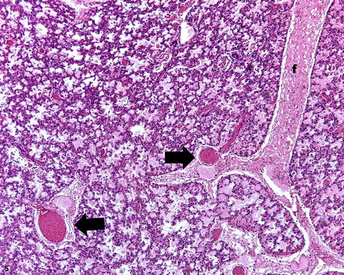 Figure 5. Pulmonary congestion, lung lobe, ovine. Septal distension with fibrin content (f) and congested vessels (arrows). H&E stain; bar = 100 μm.