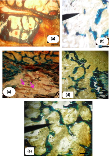 Fig. 3 The control groups in healthy bone (a), disconnected trabecular tissue in ovariectomized rat bone (b). Woven bone in OVX-BG group (c), mineralized bone implanted with BG-Zn in OVX-BG-Zn implanted group (d), and connected trabecular tissue in the OVX-BG-Zn implanted group after 90 days of implantation (e). (a, b and c, d, e Goldner's trichrome staining) (10× objective, scale bar=20 µm).