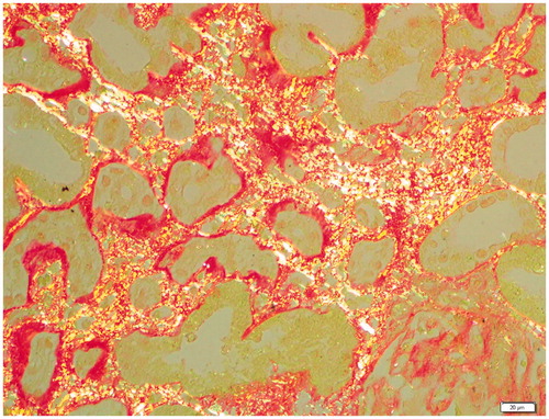 Figure 2. Yellow-green reflecting appearance of the same preparation under the polarized attachment.